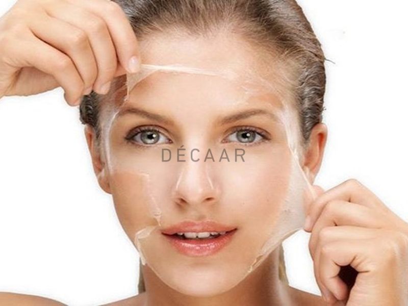 Peel da trị sẹo rỗ được không